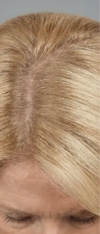 After using DearRoot