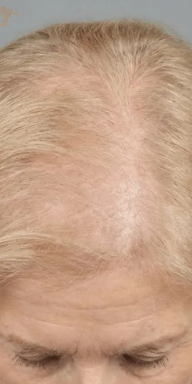 Before using DearRoot