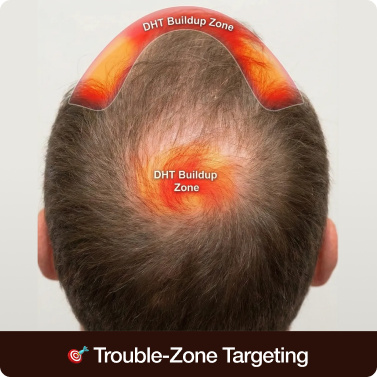 Trouble-Zone Targeting