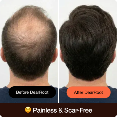 Painless & Scar-Free